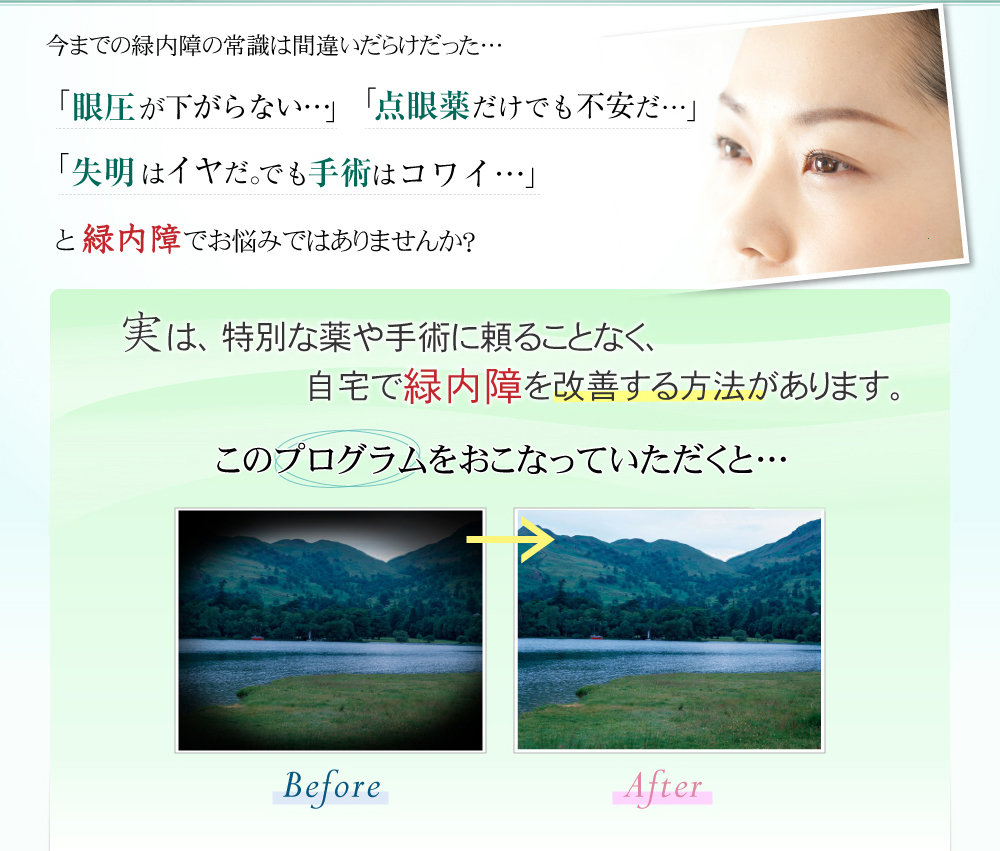 緑内障５アプローチ自宅で出来る！　緑内障改善プログラム今までの緑内障の常識は間違いだらけだった…『眼圧が下がらない…』『点眼薬だけでも不安だ…』『失明はイヤだ。でも手術はコワイ…』と緑内障でお悩みではありませんか？実は、特別な薬や手術に頼ることなく、自宅で緑内障を改善する方法があります。このプログラムをおこなっていただくと…BeforeAfter